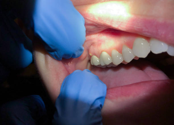 Best Pediatric Emergency Dentist in San Juan Pistrano, CA